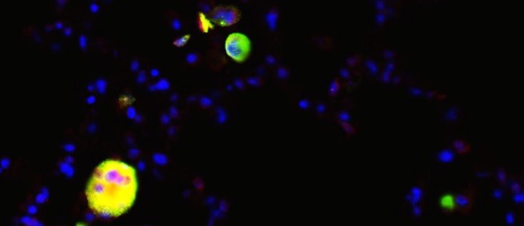 dual immunofluorescent stain of simian immunodeficiency virus (SIV) and CD68 